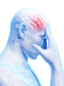 HEMIPLEJIA-DERECHA-225×300