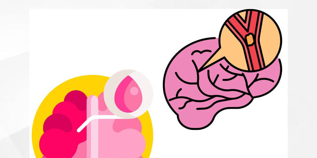 Hemorragia cerebral (1)