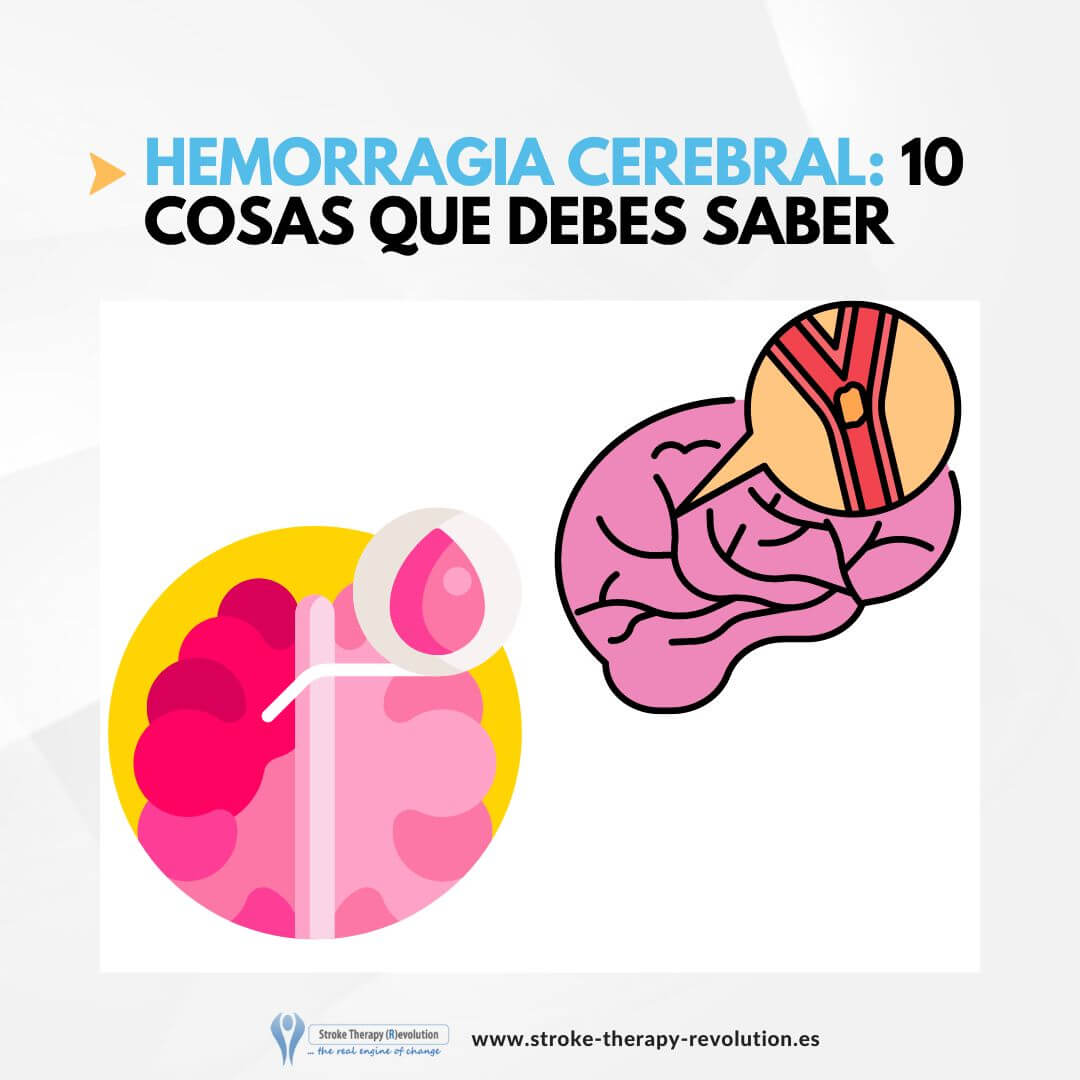Hemorragia Cerebral: 10 Cosas que Debes Saber | Guía Completa