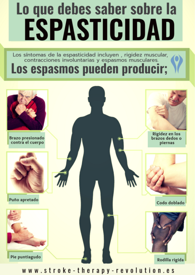 espasticidad