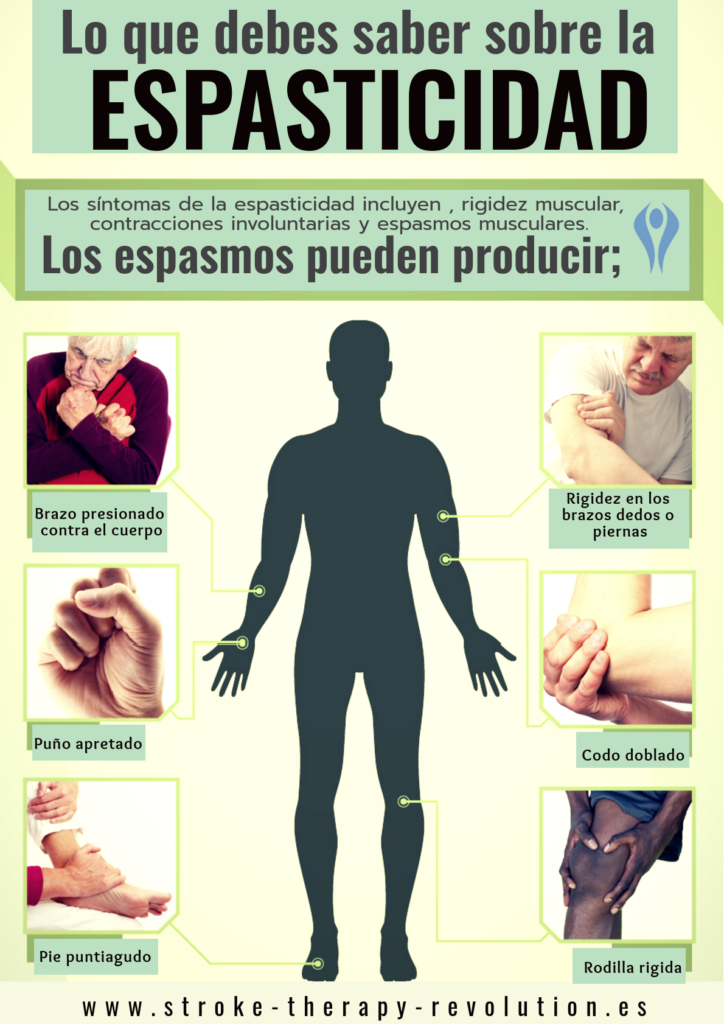 ¿SABES QUÉ ES LA ESPASTICIDAD?