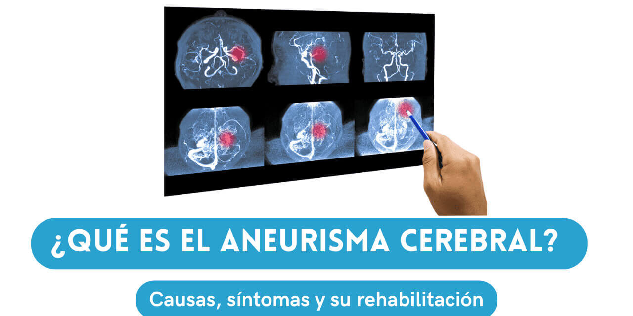 QUE ES EL ANEURISMA