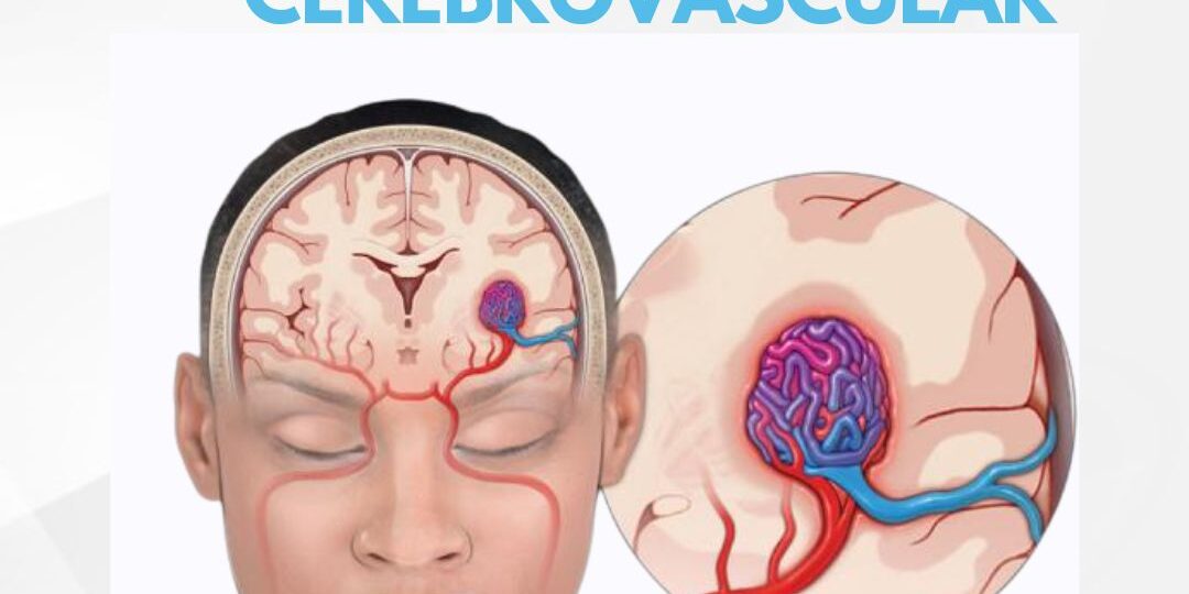 prevención ACV