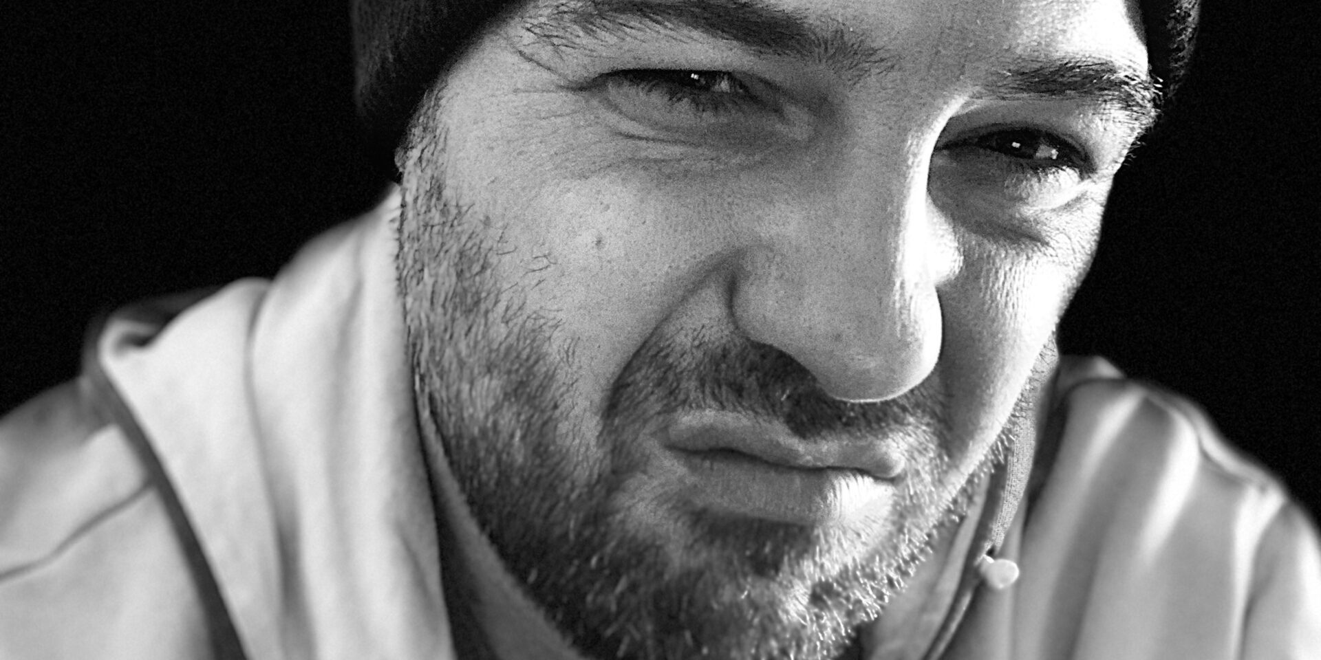 la faccia brutta della riabilitazione