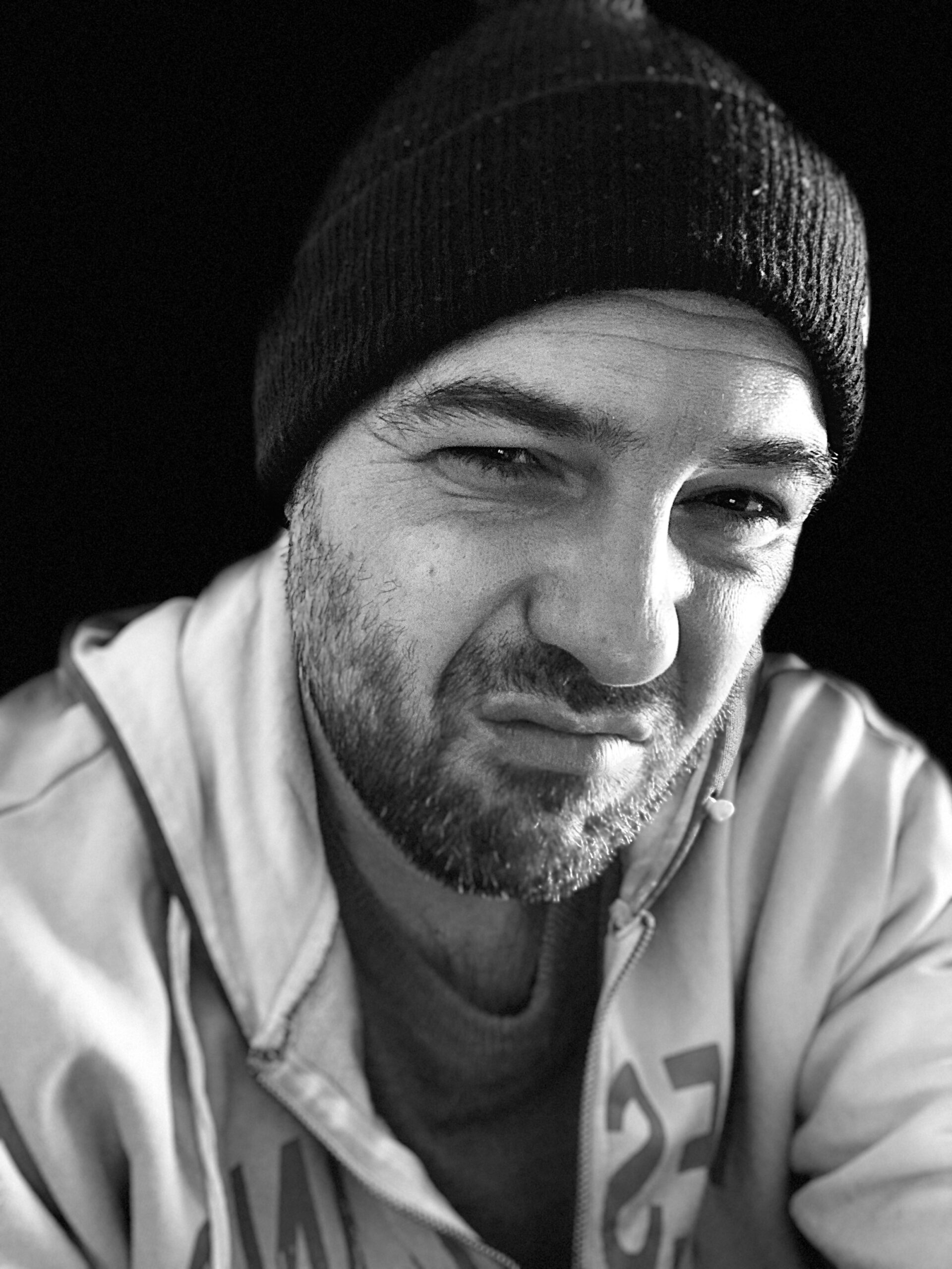 La Faccia Brutta della Riabilitazione